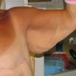 Before Before
