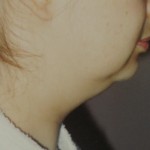 Before Before