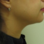After After