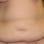 Before Before
