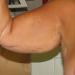 Before Before