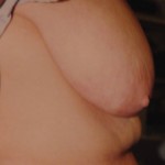 Before Before
