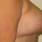 After After