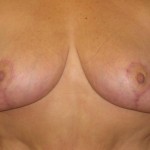 After After
