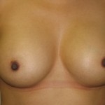 After After